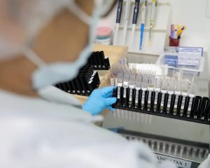 Malária: Anvisa autoriza teste em humanos de vacina 100% brasileira